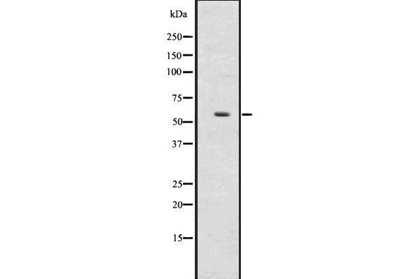 UGT2B17 anticorps  (N-Term)