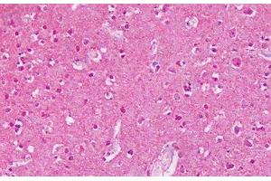 Anti-MGLUR2 / GLUR2 antibody IHC staining of human brain, cortex. (GRM2 抗体  (N-Term))
