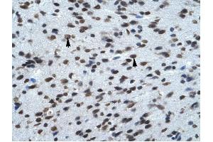 KCNK13 antibody was used for immunohistochemistry at a concentration of 4-8 ug/ml to stain Neural cells (arrows) in Human Brain. (KCNK13 抗体  (C-Term))