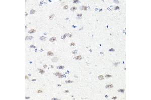 Immunohistochemistry of paraffin-embedded rat brain using CHD1 antibody (ABIN6133620, ABIN6138500, ABIN6138501 and ABIN7101818) at dilution of 1:100 (40x lens).