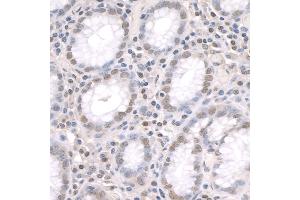 anti-Zinc Finger Protein 106 Homolog (ZFP106) (AA 1833-1883) antibody