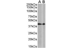 Rekombinanter CCRL2 Antikörper  (AA 1-24)