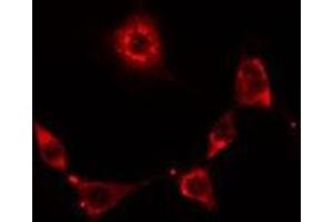 ABIN6278631 staining Hela cells by IF/ICC. (RNF19A 抗体  (N-Term))