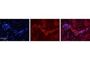 Rabbit Anti-PHF1 Antibody   Formalin Fixed Paraffin Embedded Tissue: Human heart Tissue Observed Staining: Cytoplasmic in endothelial cells in blood vessels Primary Antibody Concentration: 1:100 Other Working Concentrations: 1:600 Secondary Antibody: Donkey anti-Rabbit-Cy3 Secondary Antibody Concentration: 1:200 Magnification: 20X Exposure Time: 0.