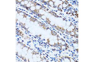 Immunohistochemistry of paraffin-embedded human colon using GIP antibody (ABIN5973668) at dilution of 1/100 (40x lens). (GIP 抗体)