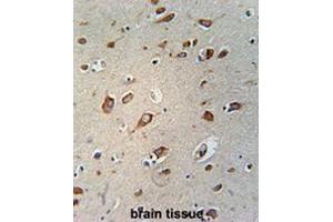 Immunohistochemistry (Paraffin-embedded Sections) (IHC (p)) image for anti-WD Repeat Containing Planar Cell Polarity Effector (WDPCP) (AA 679-709), (C-Term) antibody (ABIN950912)
