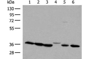 Western blot analysis of 293T and A375 cell lysates using LDHA Polyclonal Antibody at dilution of 1:250