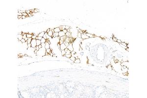 Immunohistochemistry (IHC) image for anti-CD36 (CD36) (AA 275-325) antibody (ABIN7795653) (Recombinant CD36 抗体  (AA 275-325))