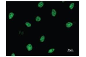 Immunostaining analysis in HeLa cells. (ASH2L 抗体)