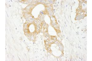 Immunohistochemistry (IHC) image for anti-Eukaryotic Translation Initiation Factor 3 Subunit J (EIF3S1) (AA 208-258) antibody (ABIN7448547) (EIF3S1 抗体  (AA 208-258))