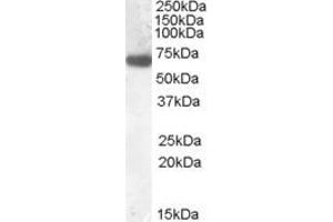 Western Blotting (WB) image for anti-Glucokinase (Hexokinase 4) Regulator (GCKR) (AA 5-18) antibody (ABIN490536)