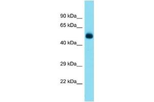 Host:  Rabbit  Target Name:  Tbx5  Sample Type:  Mouse Pancreas lysates  Antibody Dilution:  1. (T-Box 5 抗体  (N-Term))