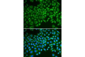 Immunofluorescence analysis of MCF-7 cells using SELE antibody. (Selectin E/CD62e 抗体)