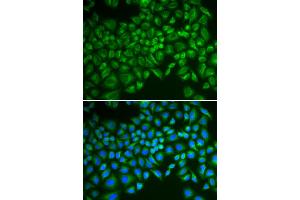 Immunofluorescence analysis of MCF-7 cells using SELE antibody. (Selectin E/CD62e 抗体)