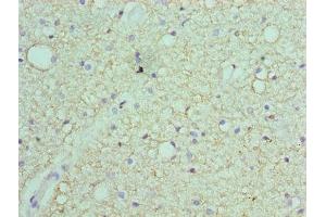 Immunohistochemistry of paraffin-embedded human brain tissue using ABIN7168870 at dilution of 1:100 (Septin 7 抗体  (AA 308-437))