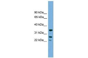 H1FOO antibody used at 1 ug/ml to detect target protein. (H1FOO 抗体  (Middle Region))