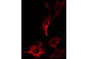 ABIN6275356 staining HepG2 cells by IF/ICC. (PITPNB 抗体  (C-Term))