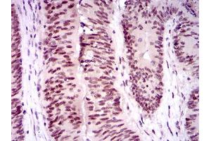 Immunohistochemistry (IHC) image for anti-Tumor Protein P53 Binding Protein 1 (TP53BP1) (AA 574-773) antibody (ABIN1724820)