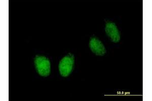 Immunofluorescence of purified MaxPab antibody to NUB1 on HeLa cell. (NUB1 抗体  (AA 1-601))