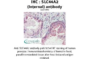 Image no. 2 for anti-Solute Carrier Family 44, Member 2 (SLC44A2) (Internal Region) antibody (ABIN1739381) (SLC44A2 抗体  (Internal Region))