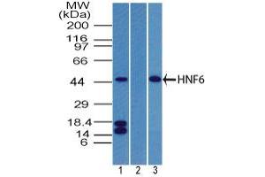 Image no. 2 for anti-One Cut Homeobox 1 (ONECUT1) (AA 420-470) antibody (ABIN960298) (ONECUT1 抗体  (AA 420-470))