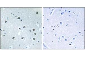 Immunohistochemistry analysis of paraffin-embedded human brain tissue, using MYO1D Antibody. (Myosin ID 抗体  (AA 825-874))