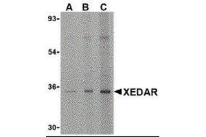 Western Blotting (WB) image for anti-Ectodysplasin A2 Receptor (EDA2R) antibody (ABIN2477154) (Ectodysplasin A2 Receptor 抗体)