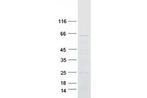 Western Blotting (WB) image for Coiled-Coil Domain Containing 11 (CCDC11) protein (Myc-DYKDDDDK Tag) (ABIN2713280)