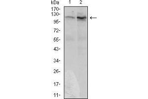Western blot analysis using DIS3L2 mouse mAb against Hela (1) and HepG2 (2) cell lysate. (DIS3L2 抗体  (AA 27-250))