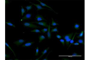 Immunofluorescence of purified MaxPab antibody to CCND2 on HeLa cell. (Cyclin D2 抗体  (AA 1-289))