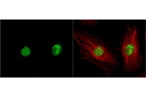 ICC/IF Image DAP Kinase 3 antibody detects DAP Kinase 3 protein at nucleus by immunofluorescent analysis. (DAPK3 抗体  (N-Term))