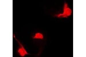 Immunofluorescent analysis of STAT5B staining in Hela cells. (STAT5B 抗体)