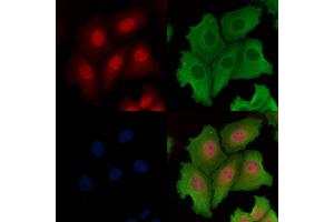 ABIN6261878 and ABIN6266545 staining Hela cells by IF/ICC. (GANP 抗体  (C-Term))