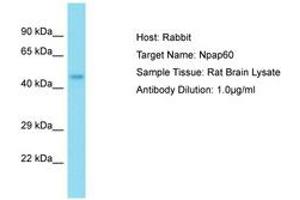 Image no. 1 for anti-Nucleoporin 50kDa (NUP50) (AA 21-70) antibody (ABIN6750333) (NUP50 抗体  (AA 21-70))