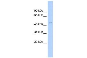 ACTL6A antibody used at 1 ug/ml to detect target protein. (BAF53A 抗体  (N-Term))