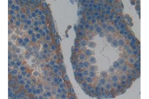 Used in DAB staining on fromalin fixed paraffin- embedded kidney tissue (LIFR 抗体  (AA 152-291))