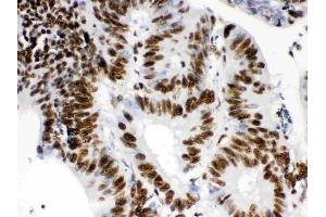 IHC analysis of RbAp48 using anti-RbAp48 antibody (ABIN3043920).