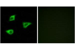 Immunofluorescence analysis of LOVO cells, using CHRM4 Antibody. (CHRM4 抗体  (AA 236-285))