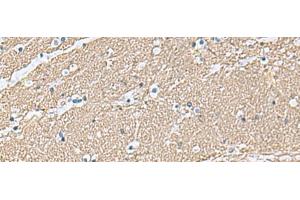 Immunohistochemistry of paraffin-embedded Human brain tissue using TAGLN3 Polyclonal Antibody at dilution of 1:70(x200) (Transgelin 3 抗体)