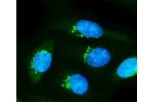 IF analysis of Alpha Internexin/INA using anti-Alpha Internexin/INA antibody (ABIN7602187).