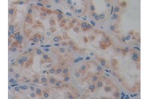 Immunohistochemistry (IHC) image for anti-Protein Tyrosine Phosphatase, Receptor Type, Q (PTPRQ) (AA 36-294) antibody (ABIN7442573)