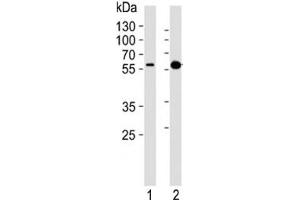 Western Blotting (WB) image for anti-PTEN Induced Putative Kinase 1 (PINK1) antibody (ABIN3028956)
