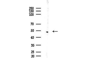 anti-Acyl-CoA Thioesterase 4 (ACOT4) (C-Term) antibody
