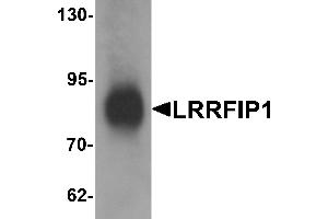 Western blot analysis of LRRFIP1 in human colon tissue lysate with LRRFIP1 antibody at 1 µg/mL. (LRRFIP1 抗体  (C-Term))