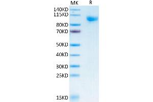 SDS-PAGE (SDS) image for Sialic Acid Binding Ig-Like Lectin 10 (SIGLEC10) (AA 17-546) protein (Fc-Avi Tag) (ABIN7275611)