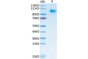 Human Siglec-10 on Tris-Bis PAGE under reduced conditions. (SIGLEC10 Protein (AA 17-546) (Fc-Avi Tag))