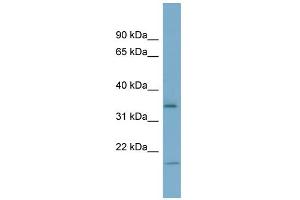 Western Blotting (WB) image for anti-Insulin-Like Growth Factor Binding Protein 2, 36kDa (IGFBP2) (Middle Region) antibody (ABIN2785659)