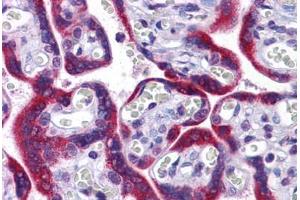 Immunohistochemistry (Formalin-fixed Paraffin-embedded Sections) (IHC (fp)) image for anti-Karyopherin (Importin) alpha 4 (KPNA4) (N-Term) antibody (ABIN625983)