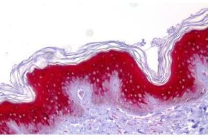 Anti-IVL / Involucrin antibody IHC staining of human skin. (Involucrin 抗体)