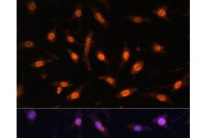 Immunofluorescence analysis of L929 cells using WT1 Polyclonal Antibody at dilution of 1:100. (WT1 抗体)
